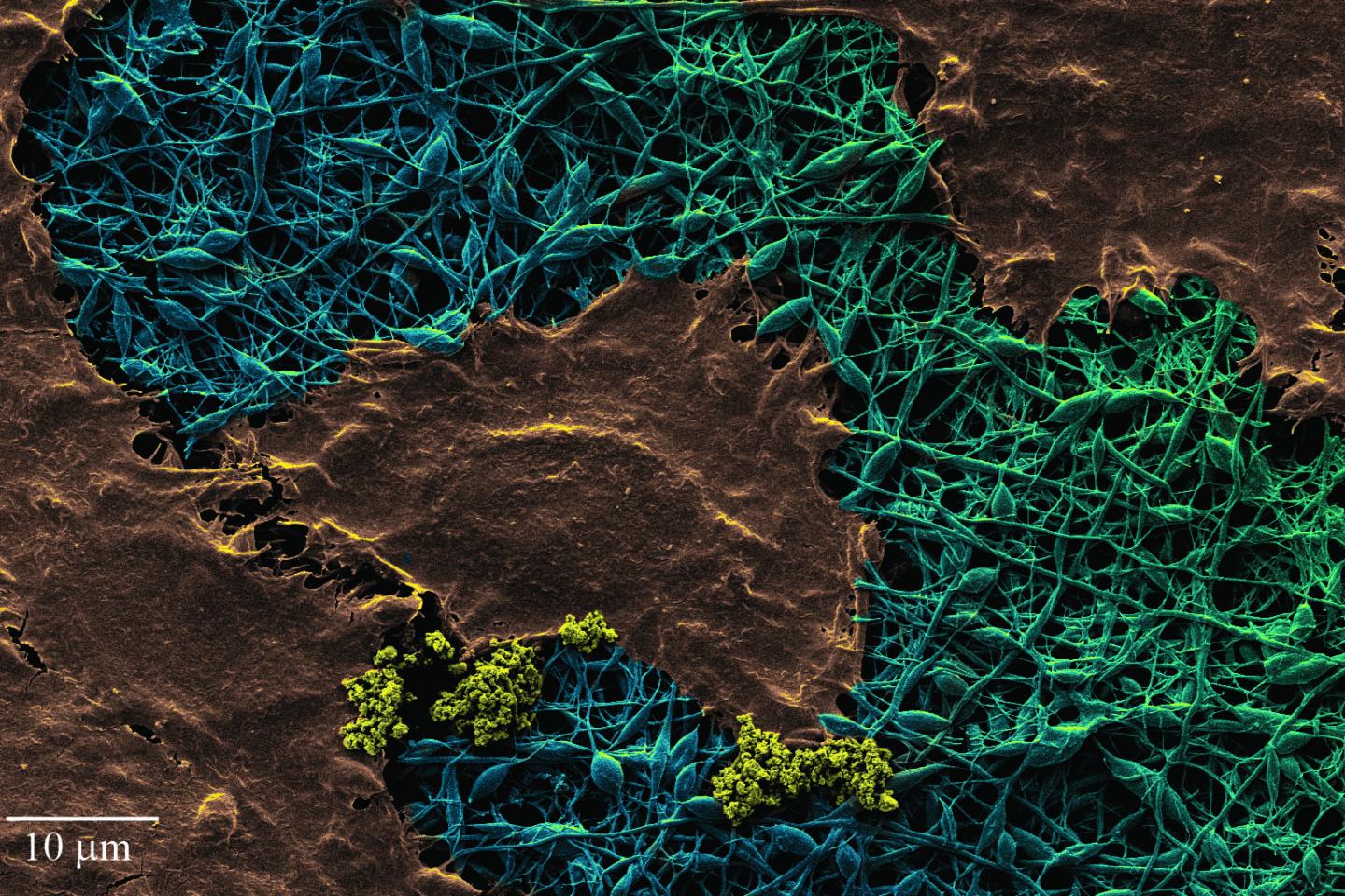 Image 1:Smart wound dressing