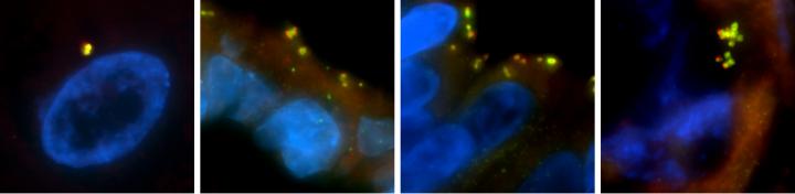 Centrosome Amplification Occurs at An Early Stage of Barrett's Esophagus