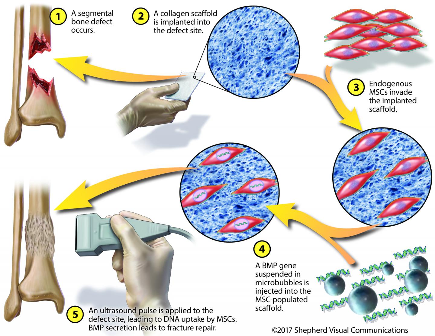 Tiny Bubbles Help Heal Broken Bones, In Pigs (4 of 4)