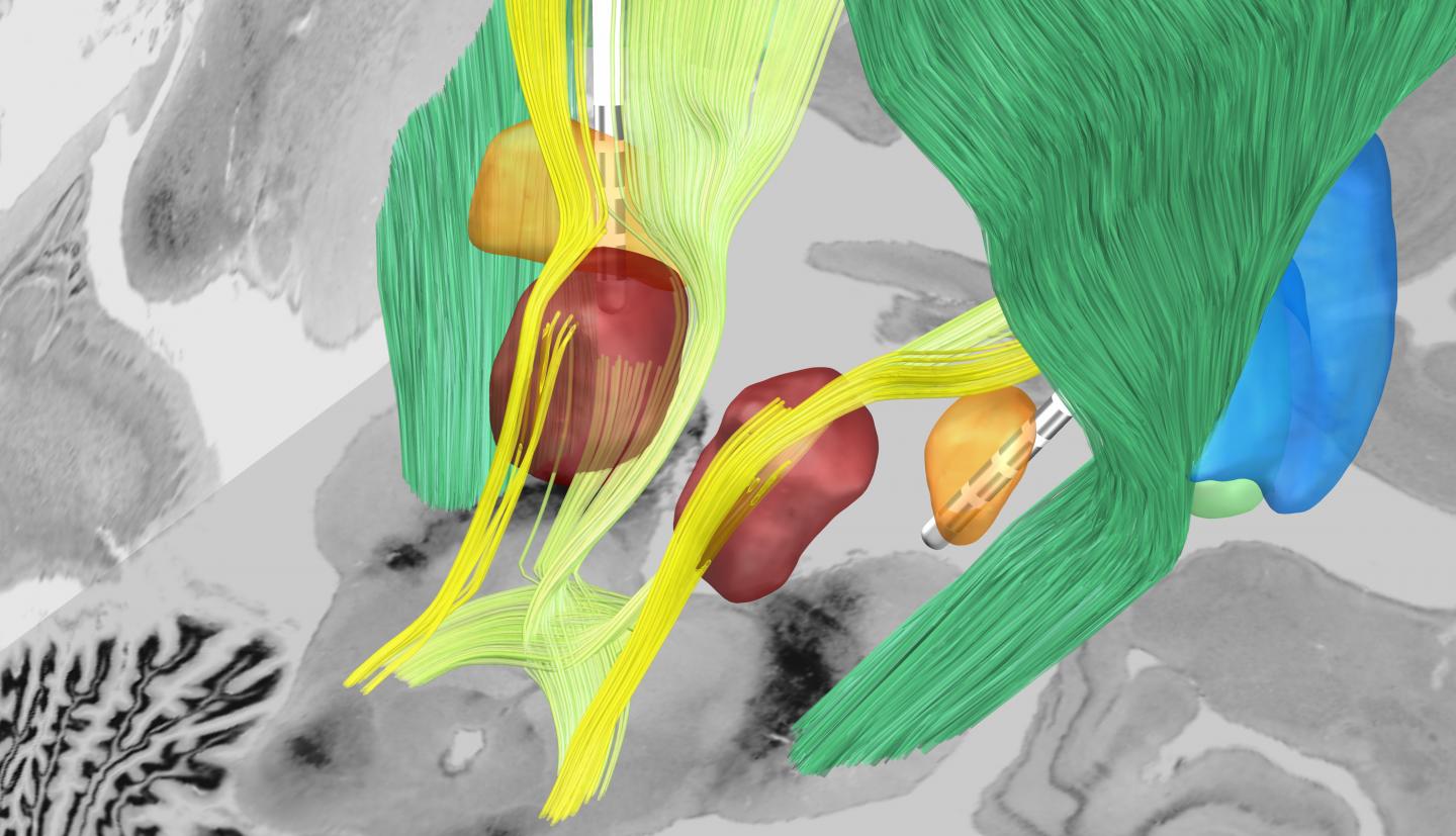 Target Region for Stimulation