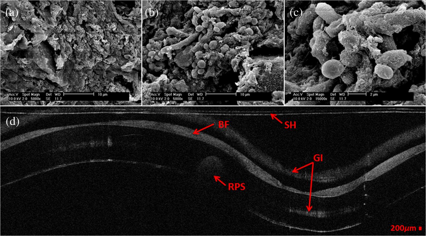 Biofilm Images from Endotracheal Tubes (1 of 2)