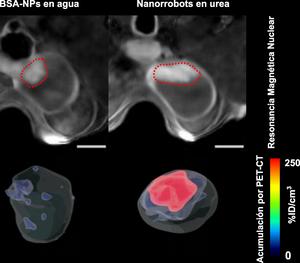 2_Acumulación nanorrobots en el tumor por PET-CT