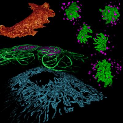 Bessel Beam Plane Illumination Montage