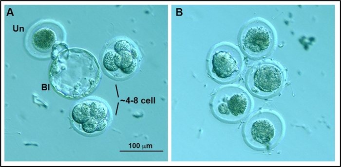 New Study Sheds Light On How An Autoimmune Di | EurekAlert!