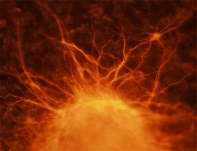 A Differentiating Cell