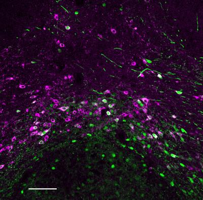 Neuronal connections between the two major brain areas implicated in drug withdrawal