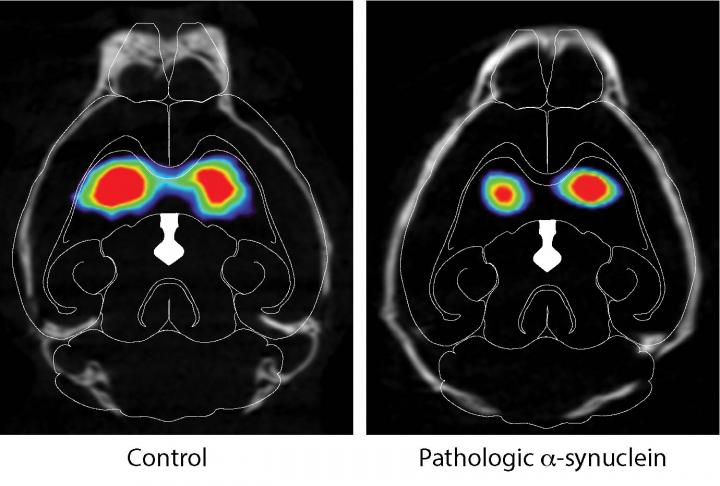 Effect of Pathologic Alpha-Synuclein Injection