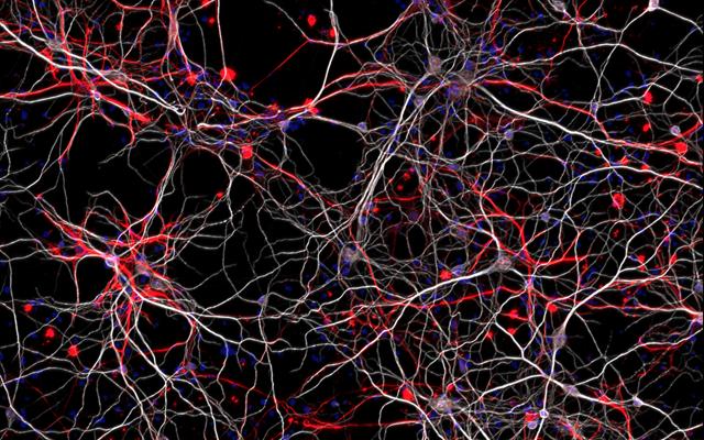 Autism Neurons, UC San Diego School of Medicine