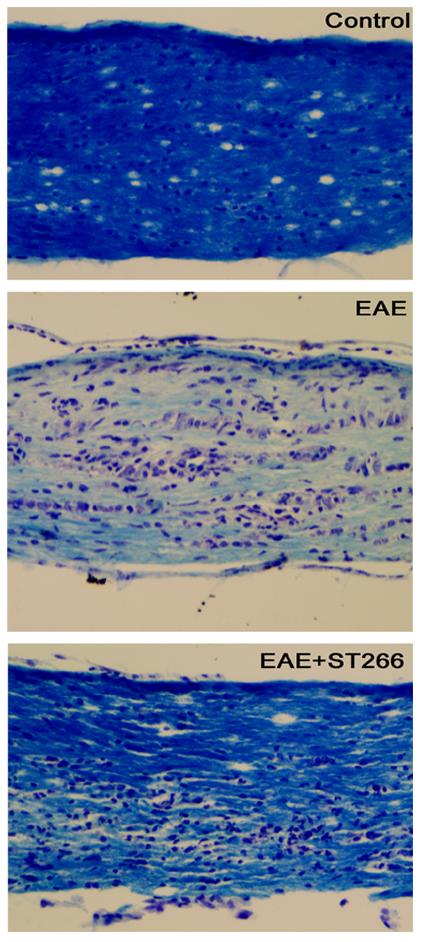Optic Neuritis in MS Mouse