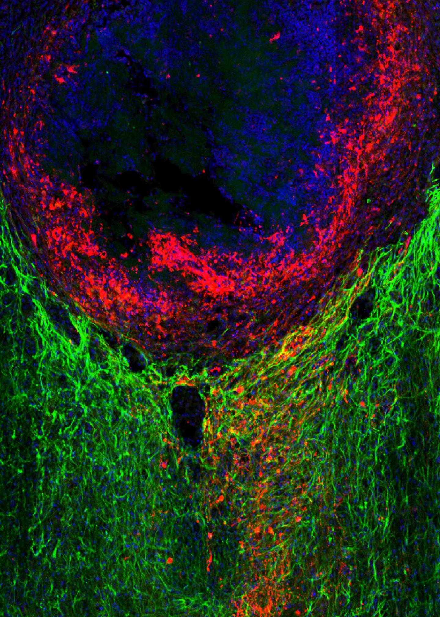 Benefits of Scarring