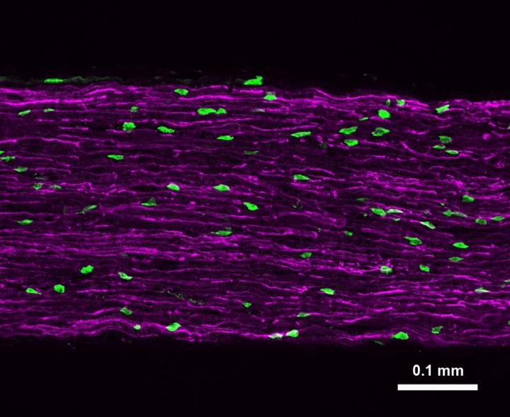 Immune Cleanup Crew?