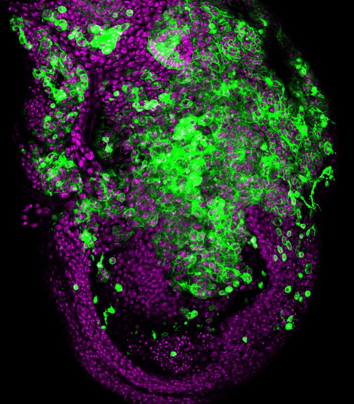 Chromosomal instability