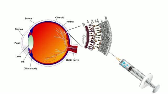 Artificial Liquid Retina