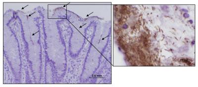 Ulcer-Causing Bacteria