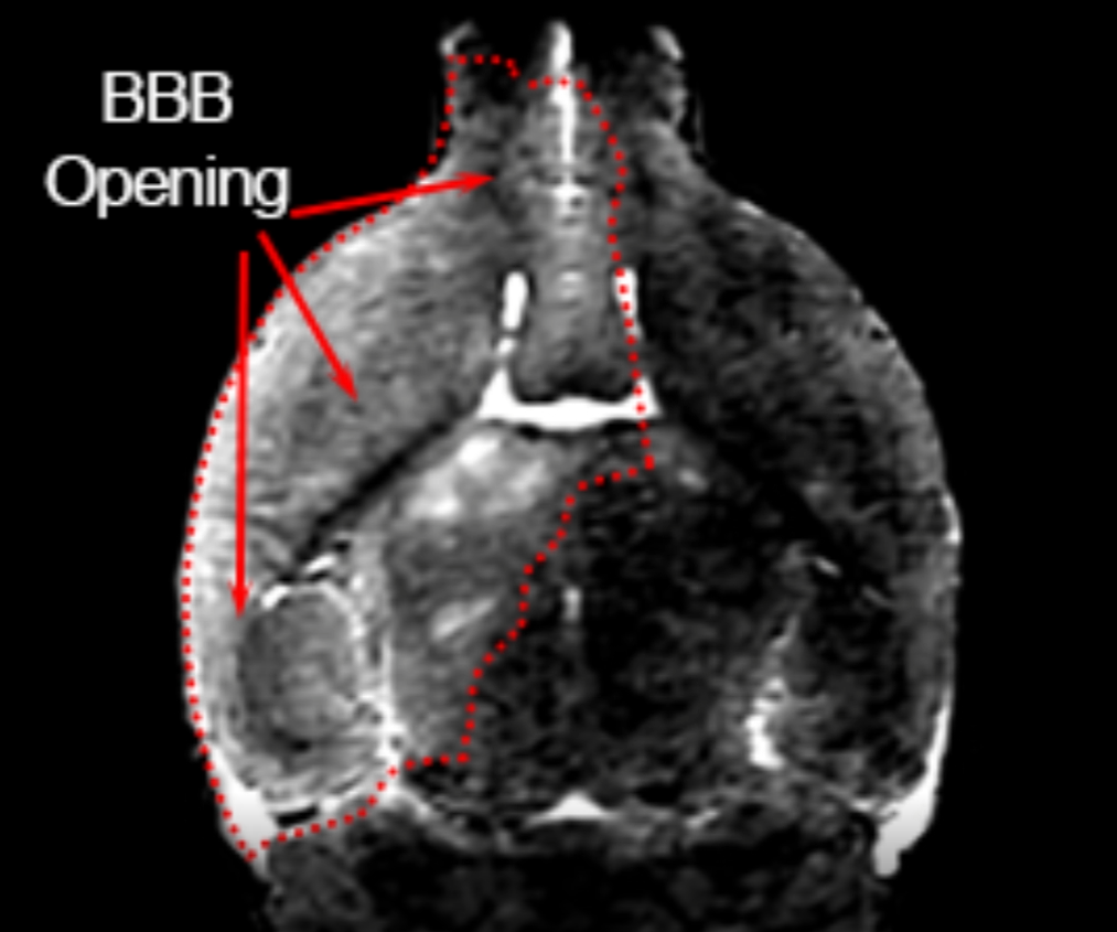 Crossing Blood-Brain Barrier in Mouse