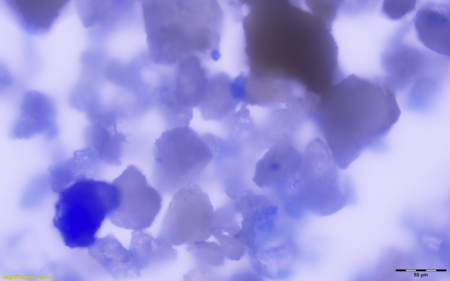 Rare and Expensive Blue Pigment Found in the Dental Calculus of a Medieval-Era Woman (8 of 8)