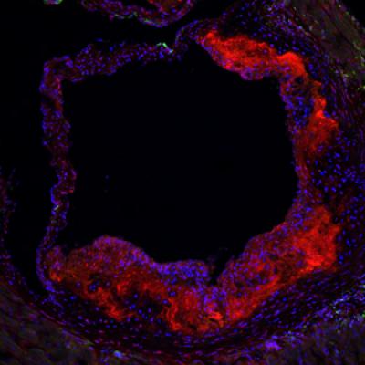 Atherosclerosis in Mouse Aorta