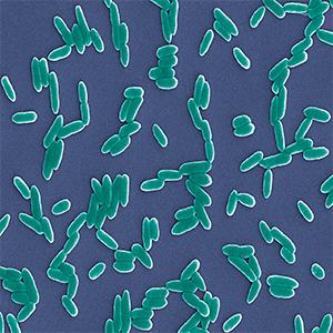 <i>Pseudomonas aeruginosa</i>