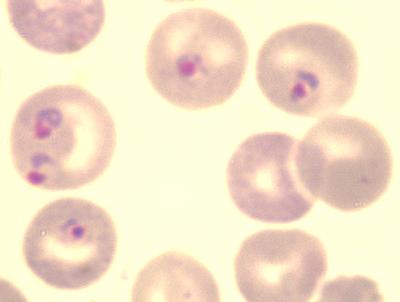 Plasmodium Berghei