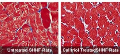 Heart Damage Prevented