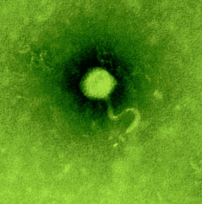 Electron Microscopic Picture of a Bacteriophage