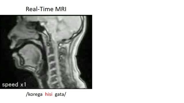 「ヒ」と「シ」のシミュレーション