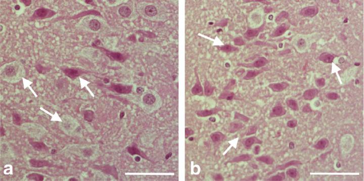 High power light microscopic images of hippocampus