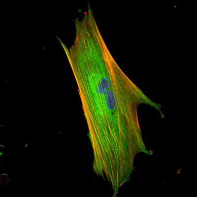 Fibroblast