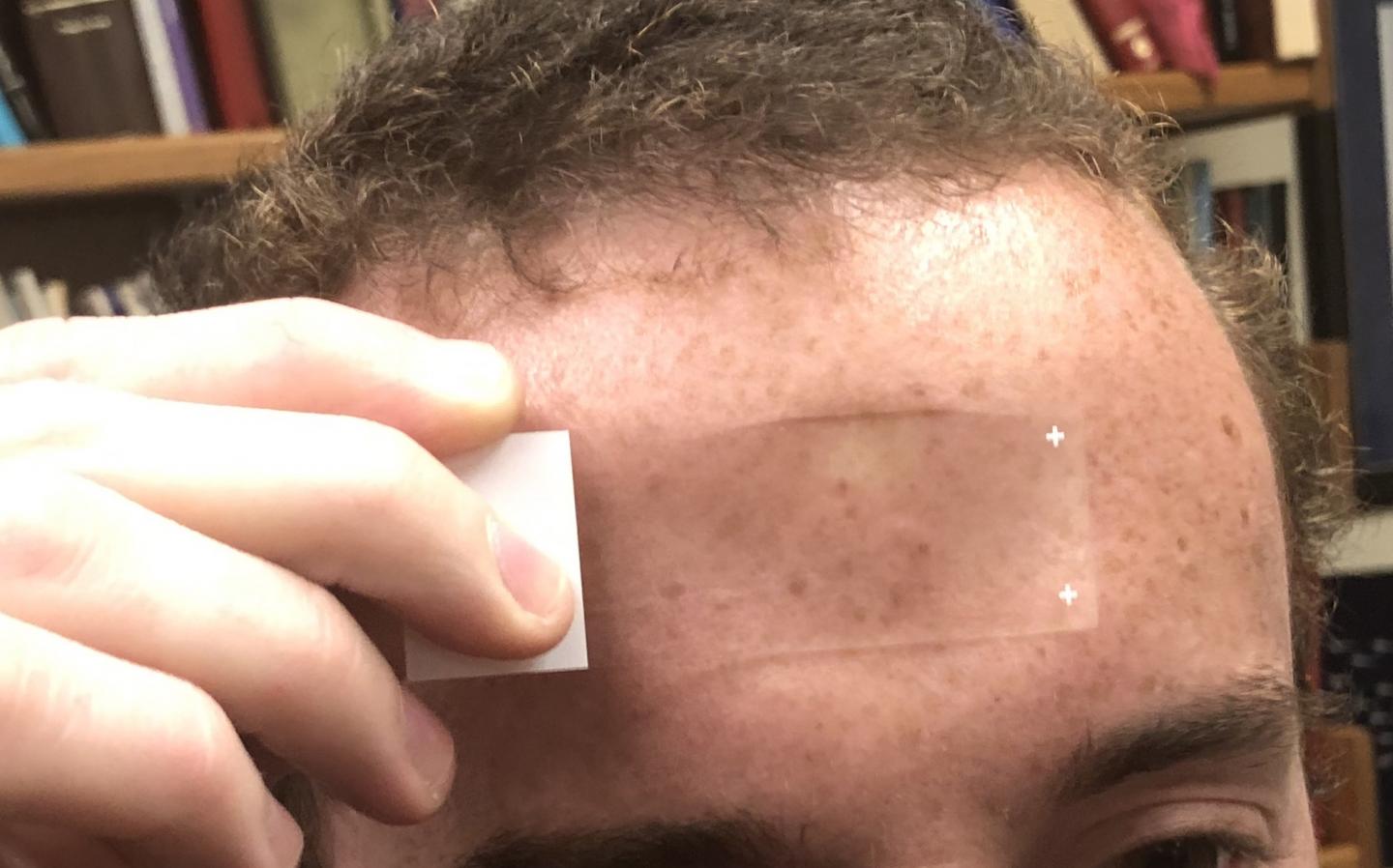 A Microscope Slide Is Swiped across the Forehead to Obtain a Perspiration Sample
