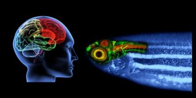 Brain: Human vs. Zebrafish