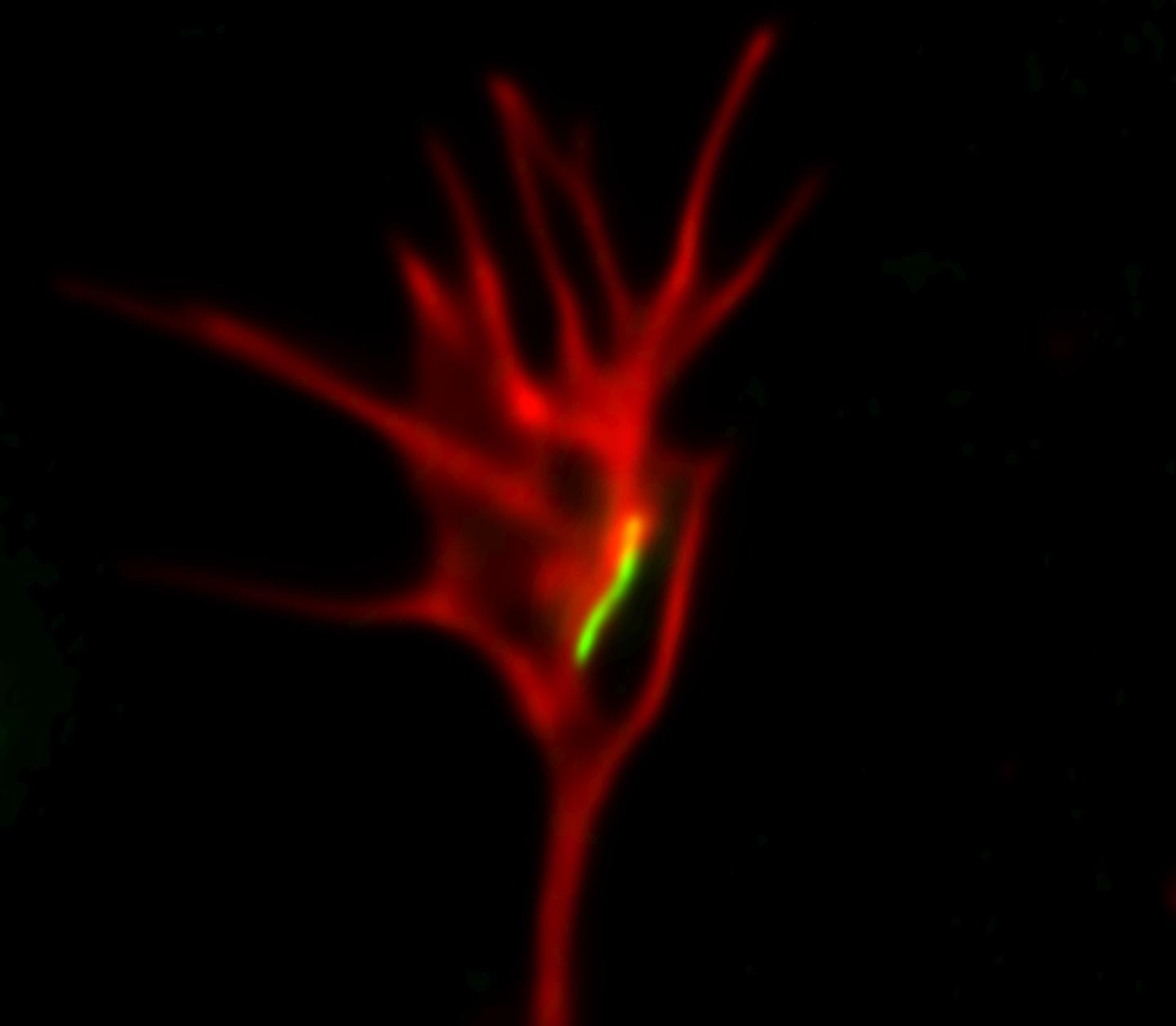 Mitochondrial Dynamics Impair Nervous System Development in Wolfram Syndrome