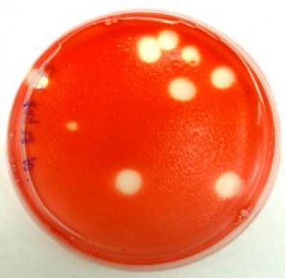 Bacteria and Viruses