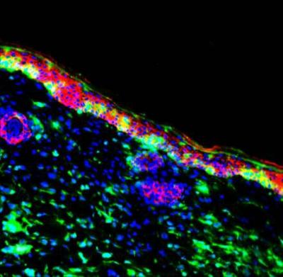 Bone Marrow Cells