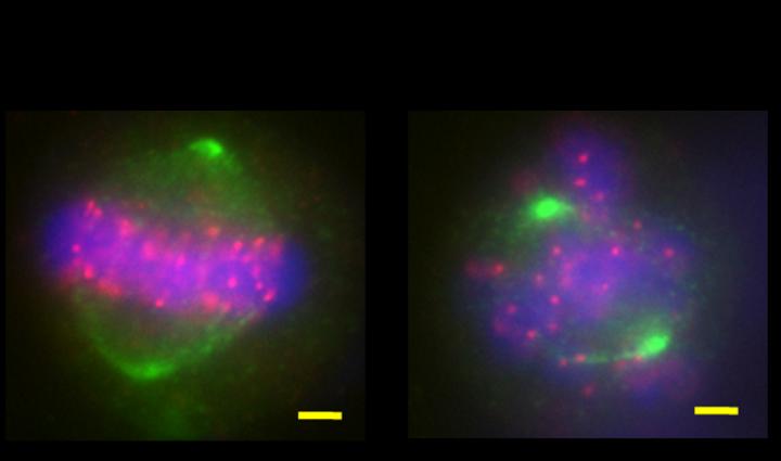 New Protein Complex Gets Chromosomes Sorted