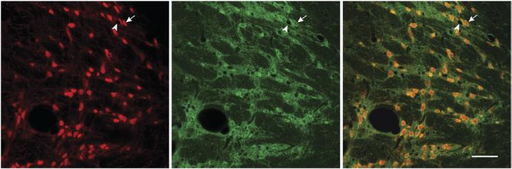 Neural Gatekeeper in the Brain Controls Attention and Focus