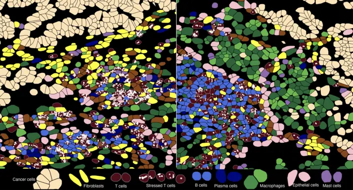 High-resolution spatial profiling image showing stressed T cells within the tumor microenvironment