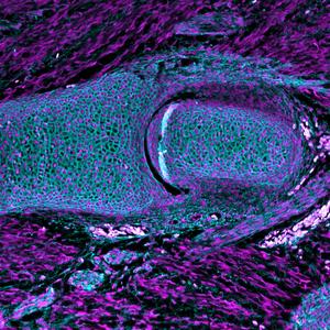 Humans inherited their flexible joints from the earliest jawed fish