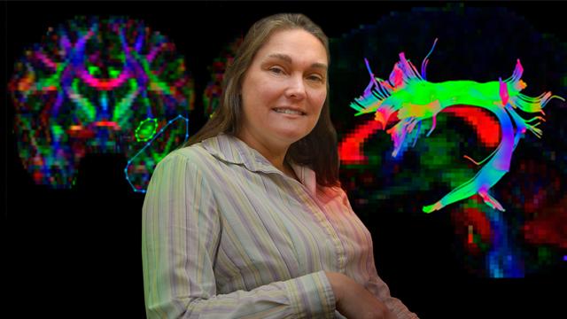 Catherine Davis, Medical College of Georgia at Georgia Regents University