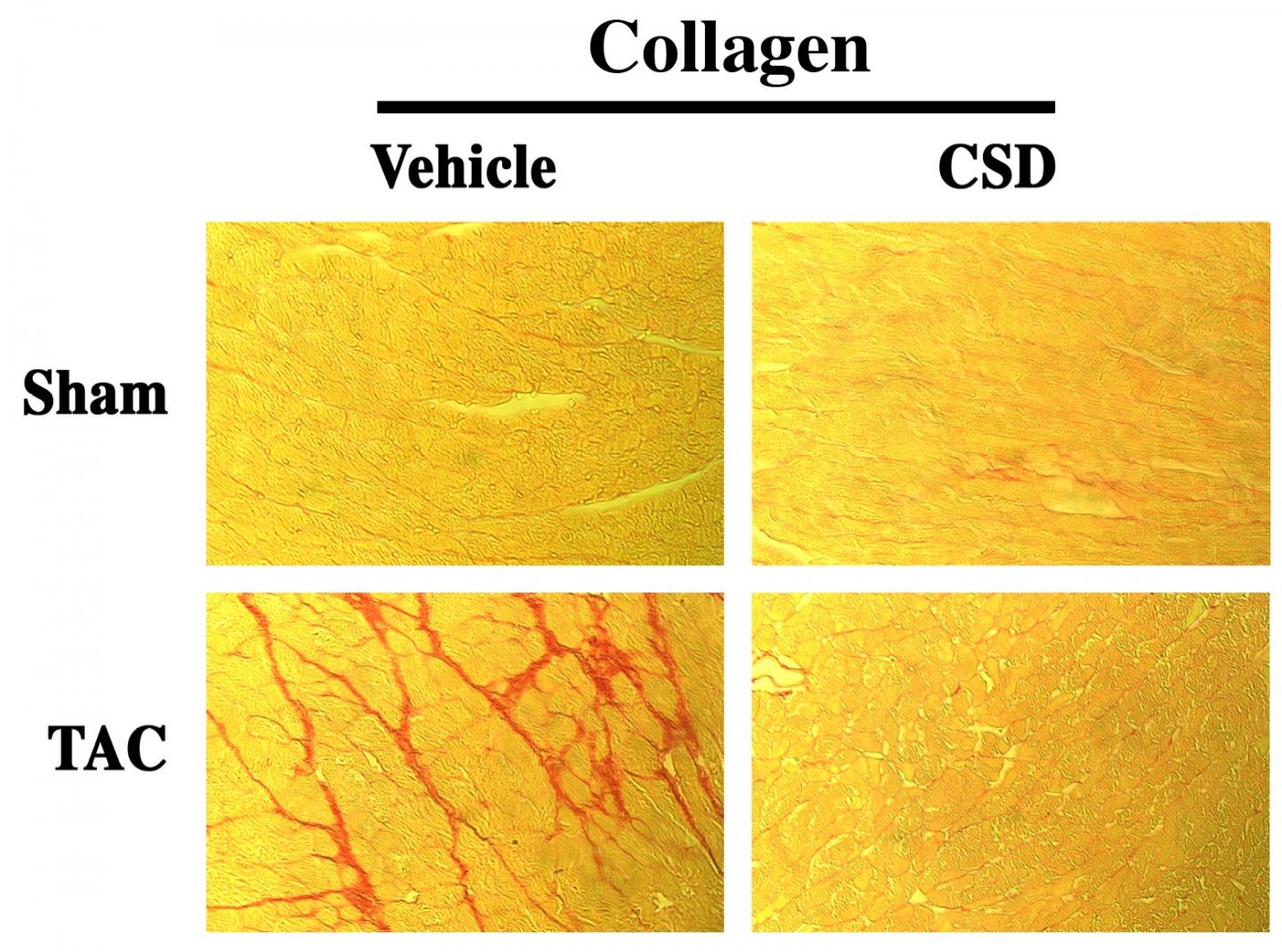 Caveolin-1 Saffolding Domain (CSD) Peptide Reverses Collagen Accumulation in Pressure Overloaded (Ta