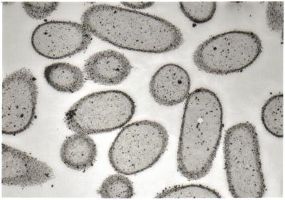 <I>E. coli</i> Cells Surrounded By Nanoparticles of Palladium and Gold