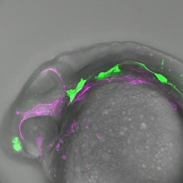 Vessels and Neuroblasts Development