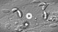 How <I>Toxoplasma</i> Parasites Glide so Swiftly (Video)