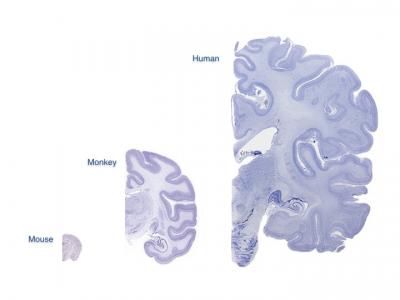 Mouse/Monkey/Human Brain Cross-Section