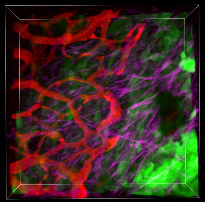 Microscopic view inside mouse model of pancreatic cancer tumour.