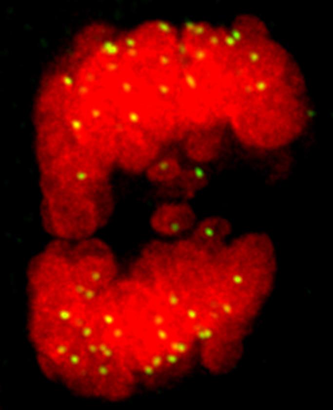 Chromosome Pairing Is Crippled in Some Unstable Cancer Cells