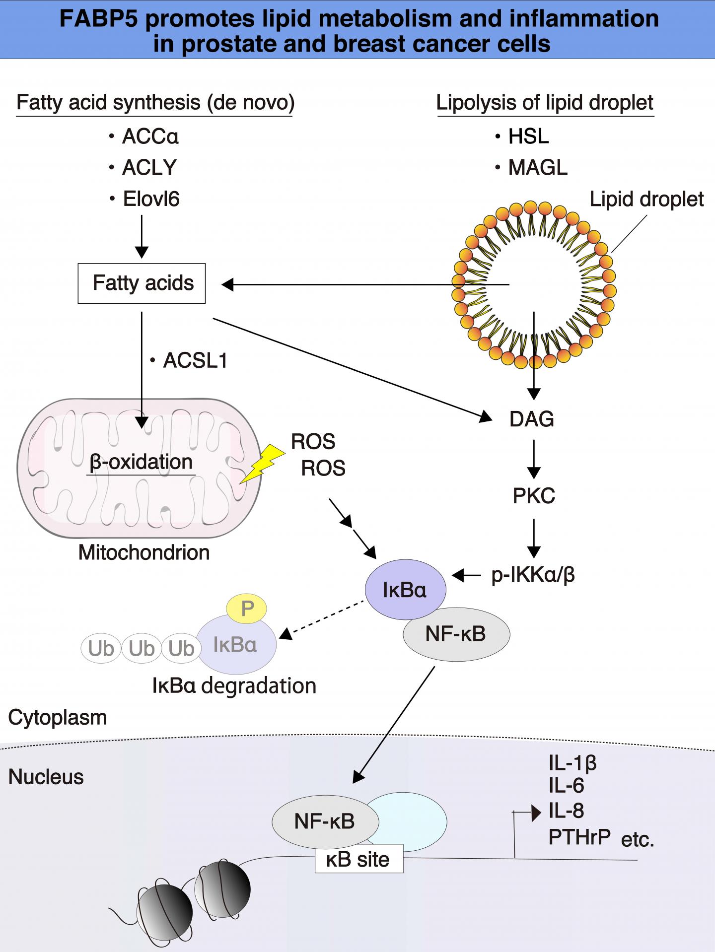 FABP5 Promotes Lipid Metabolism and Inflammation in Prostate and Breast Cancer Cells