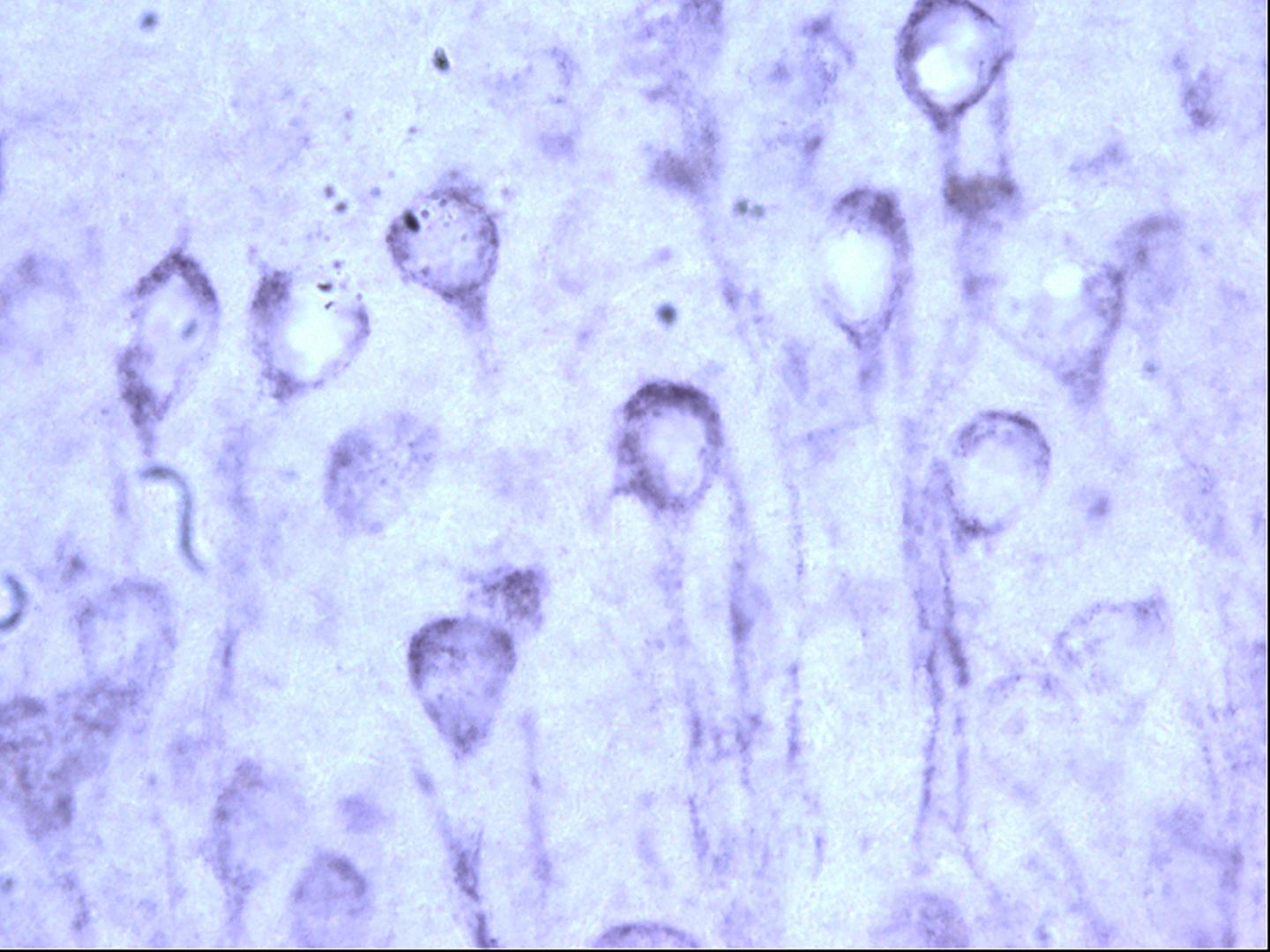 Microscopic image of tau pathology