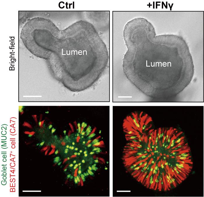 Intestinal organoid