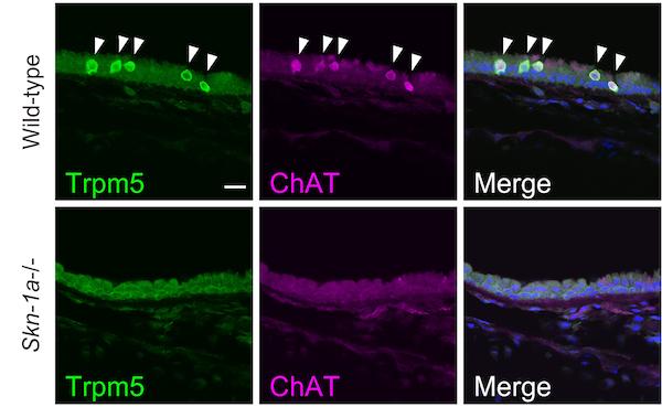 Bio-Imaging of Trachea in Wild-Type (Top Row) and Skn-1a Knockout Mice (Bottom Row)