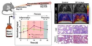 Preclinical molecular imaging of pulmonary fibrosis progression.